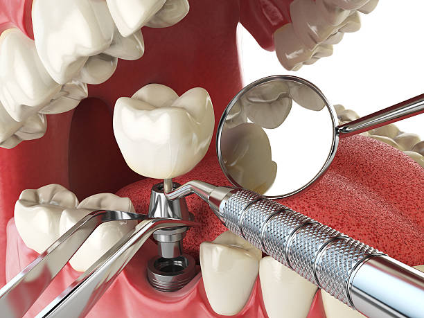 Best Emergency Care for Gum Disease in Vienna, VA